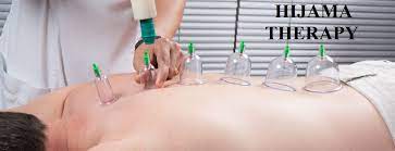 WET CUPPING  HIJAMA THERAPY